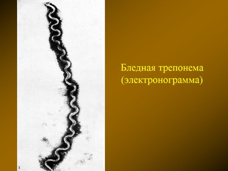 Бледная трепонема (электронограмма)